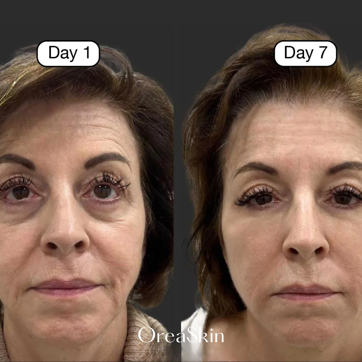 OreaSkin Lymphatic Contour Face Brush