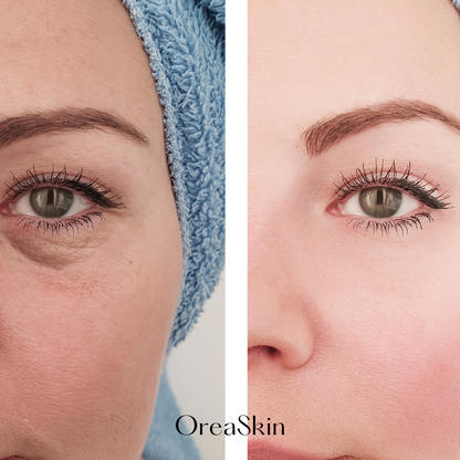 OreaSkin Lymphatic Contour Face Brush