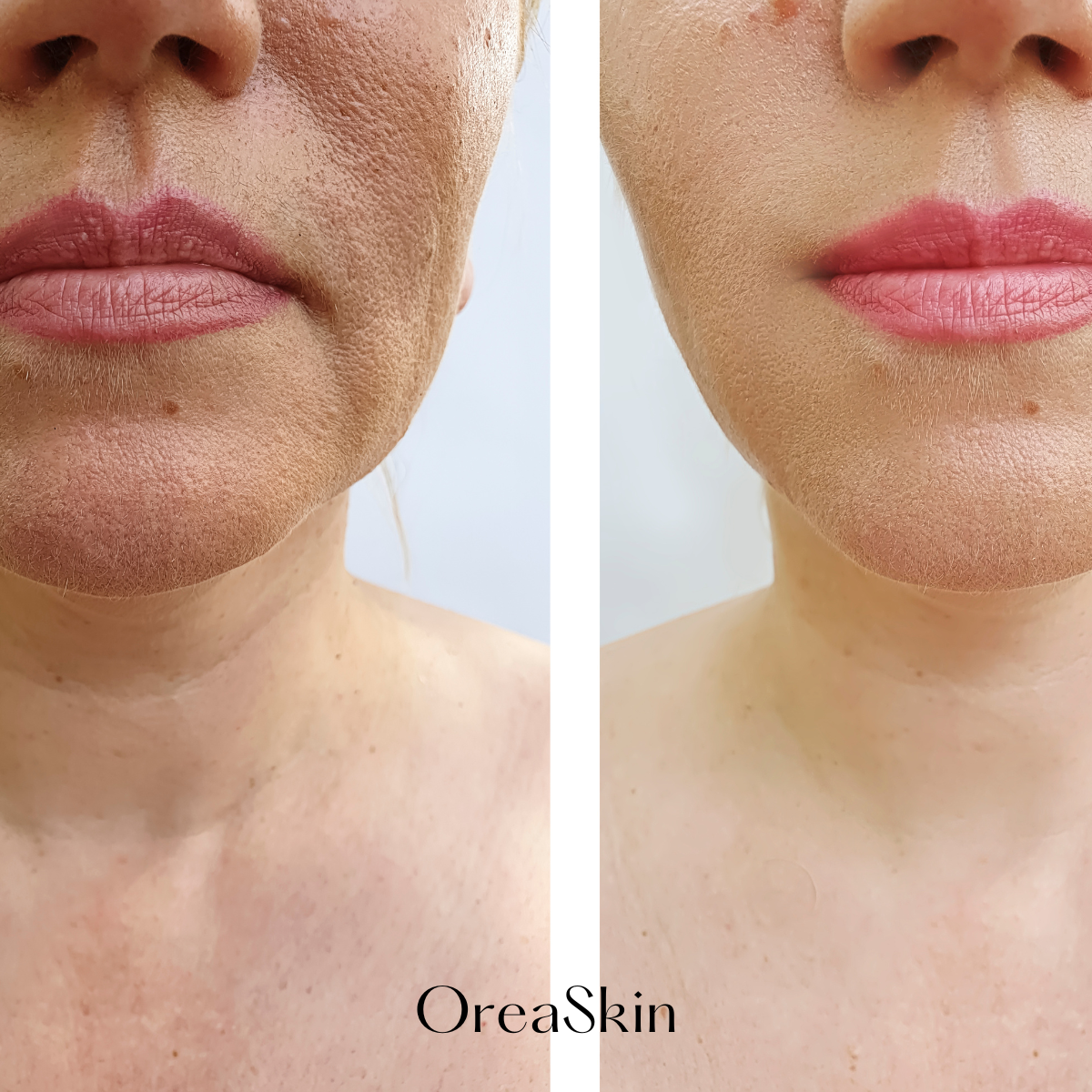 OreaSkin Lymphatic Contour Face Brush