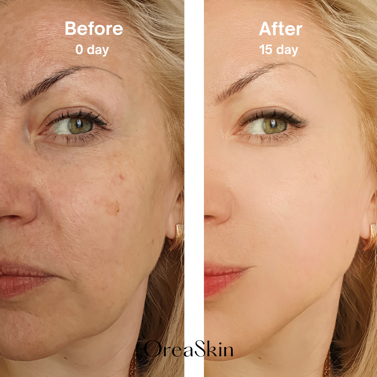 OreaSkin Lymphatic Contour Face Brush