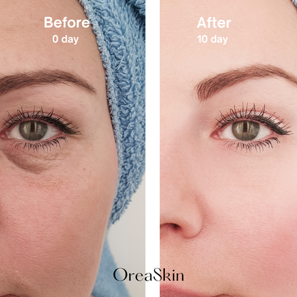 OreaSkin Lymphatic Contour Face Brush