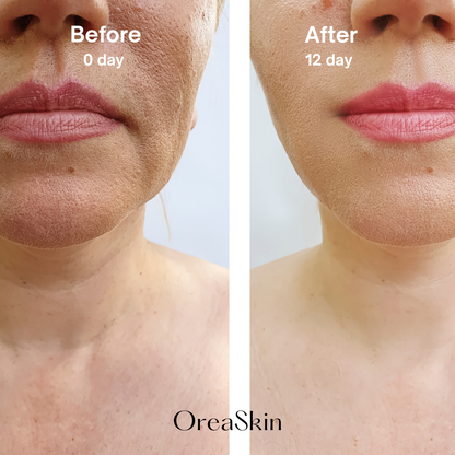 OreaSkin Lymphatic Contour Face Brush