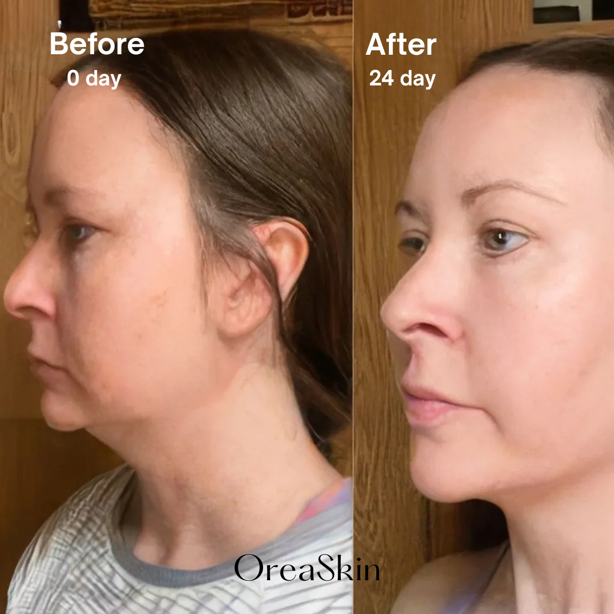 OreaSkin Lymphatic Contour Face Brush