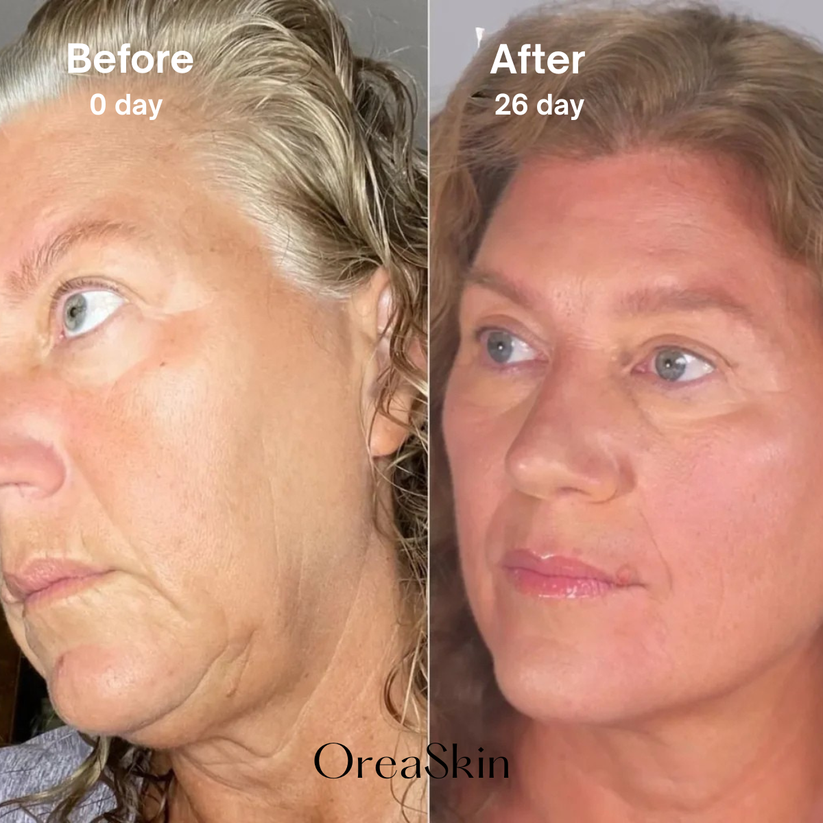 OreaSkin Lymphatic Contour Face Brush