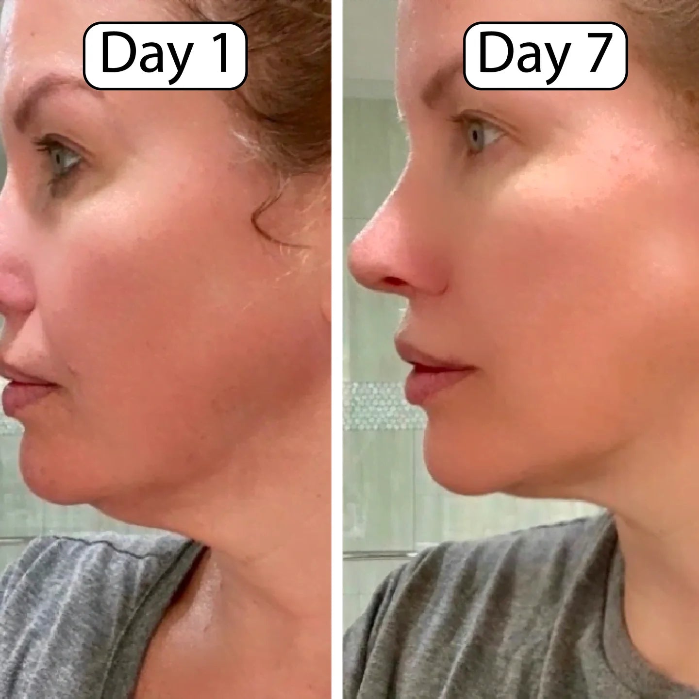 OreaSkin Lymphatic Contour Face Brush